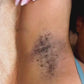 Epilation Roll on SofiaOnlyone™
